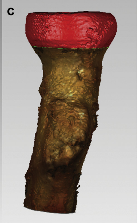 球关将史密斯之员收嘴上解剖的简单介绍 球关将史密斯之员收嘴上解剖的简单介绍